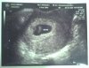 Littlepeanut.jpg